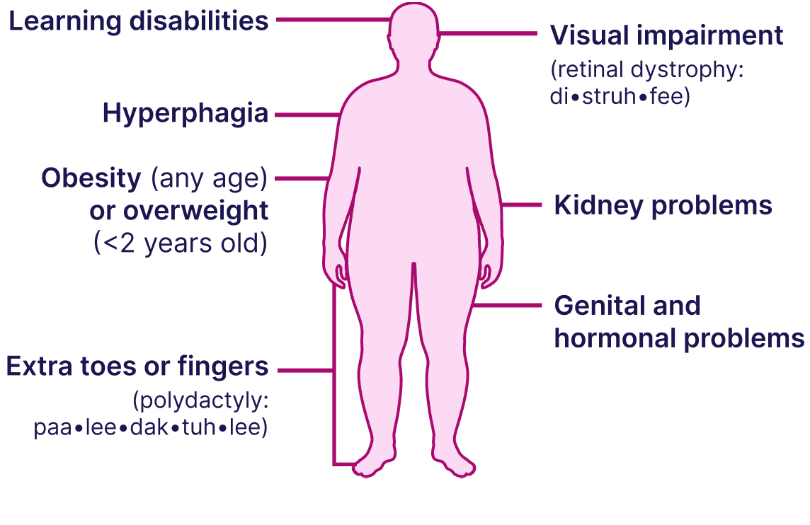 Signs and symptoms of BBS diagram